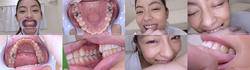 [With bonus video] Hikari Sakuraba&#39;s teeth and bite series 1-2 collectively DL