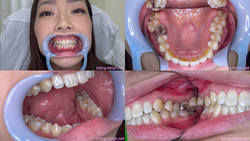 【牙齿恋物癖】我们观察了田中丽娜的牙齿！