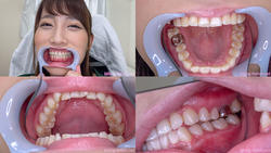 【牙齒戀物癖】我看到了庫拉塔先生的牙齒！