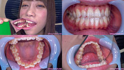 【牙齿恋物癖】我观察了Kiyama Kayu的牙齿！