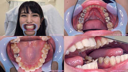 [Teeth fetishism] I observed Kuraki Shiori-chan&#39;s teeth!